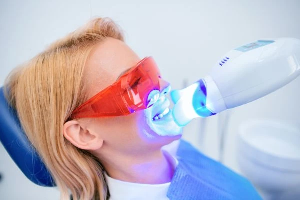 Blue light teeth whitening Berkshire from LA Teeth Whitening! Book today! Castle-Bromwich