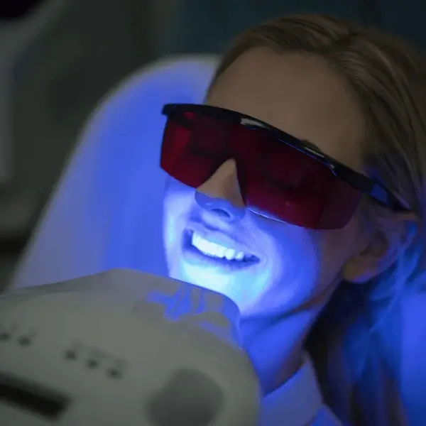 How Does Laser Whitening Adapt for Clients with Retainers Castle-Bromwich